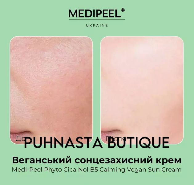 Веганский солнцезащитный крем Medi Peel Phyto Cica, 50 мл 4150 фото