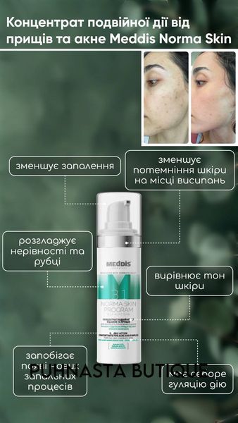 Концентрат двойного действия против акне и прыщей Meddis Norma Skin Program, 30 мл 55321 фото
