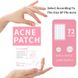 Патчи от прыщей Sersanlove ACNE PATCH (с азиатской центелой), 72 шт 54445 фото 3